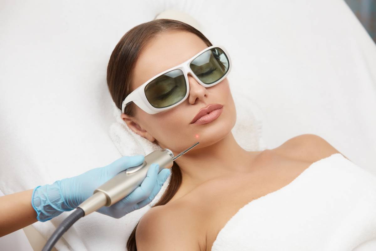 Tout sur l’épilation laser