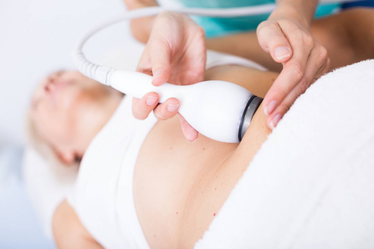 Sur quelles zones peut-on utiliser la cryolipolyse ?