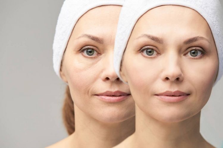 Testez les injections d’acide hyauronique