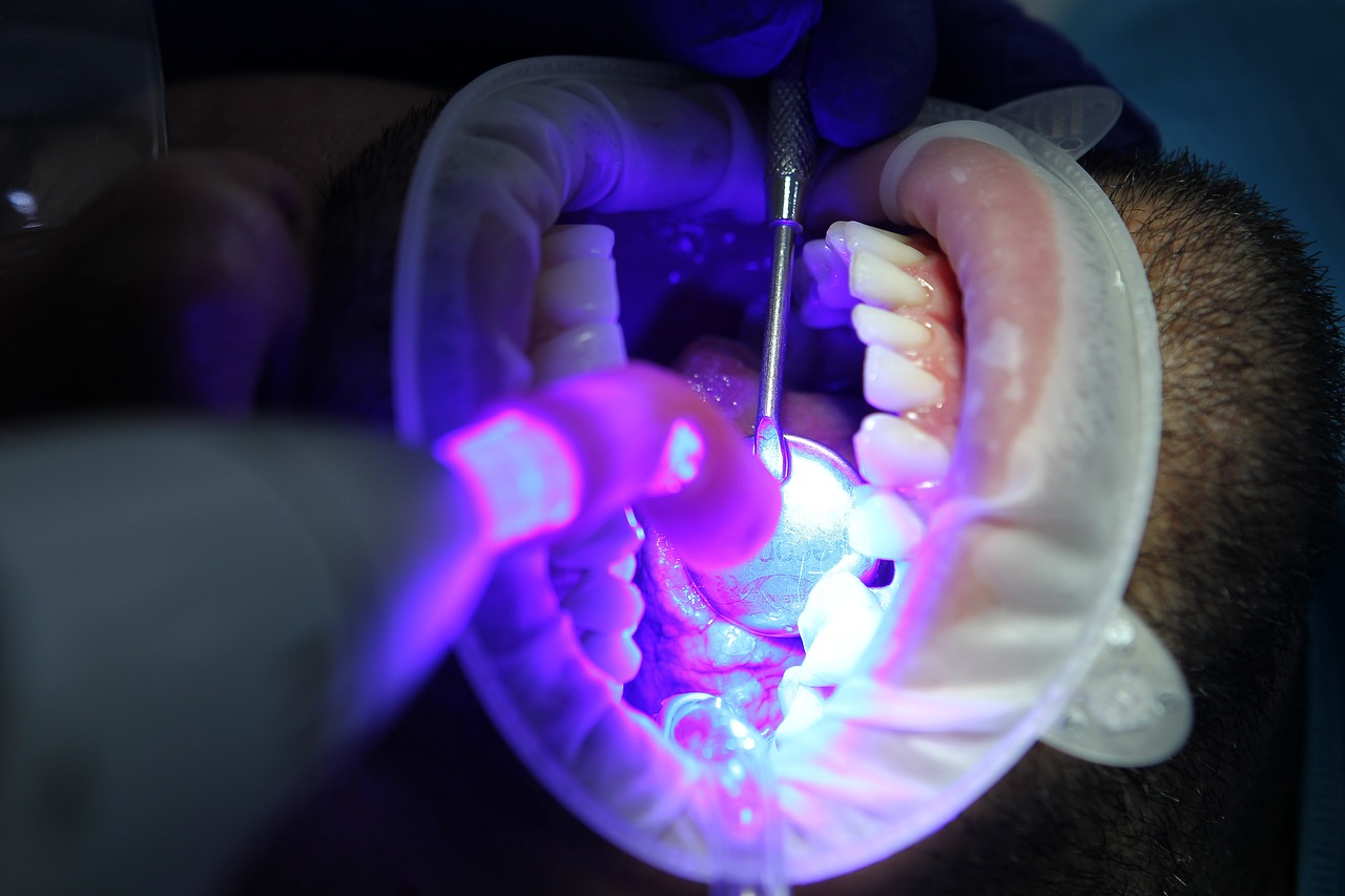 Astuce femme : comment blanchir vos dents de façon naturelle ?