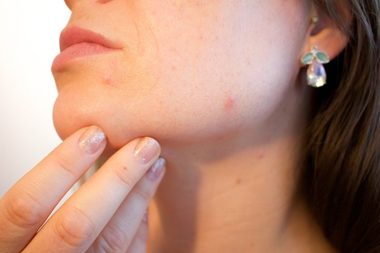 Comment couvrir les cicatrices sur le visage avec le maquillage ?
