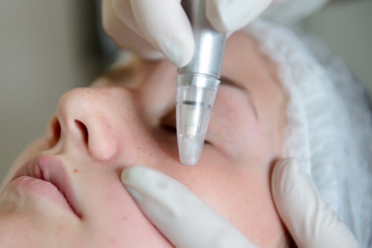 La microdermabrasion à domicile : un traitement spa simple et naturel à domicile