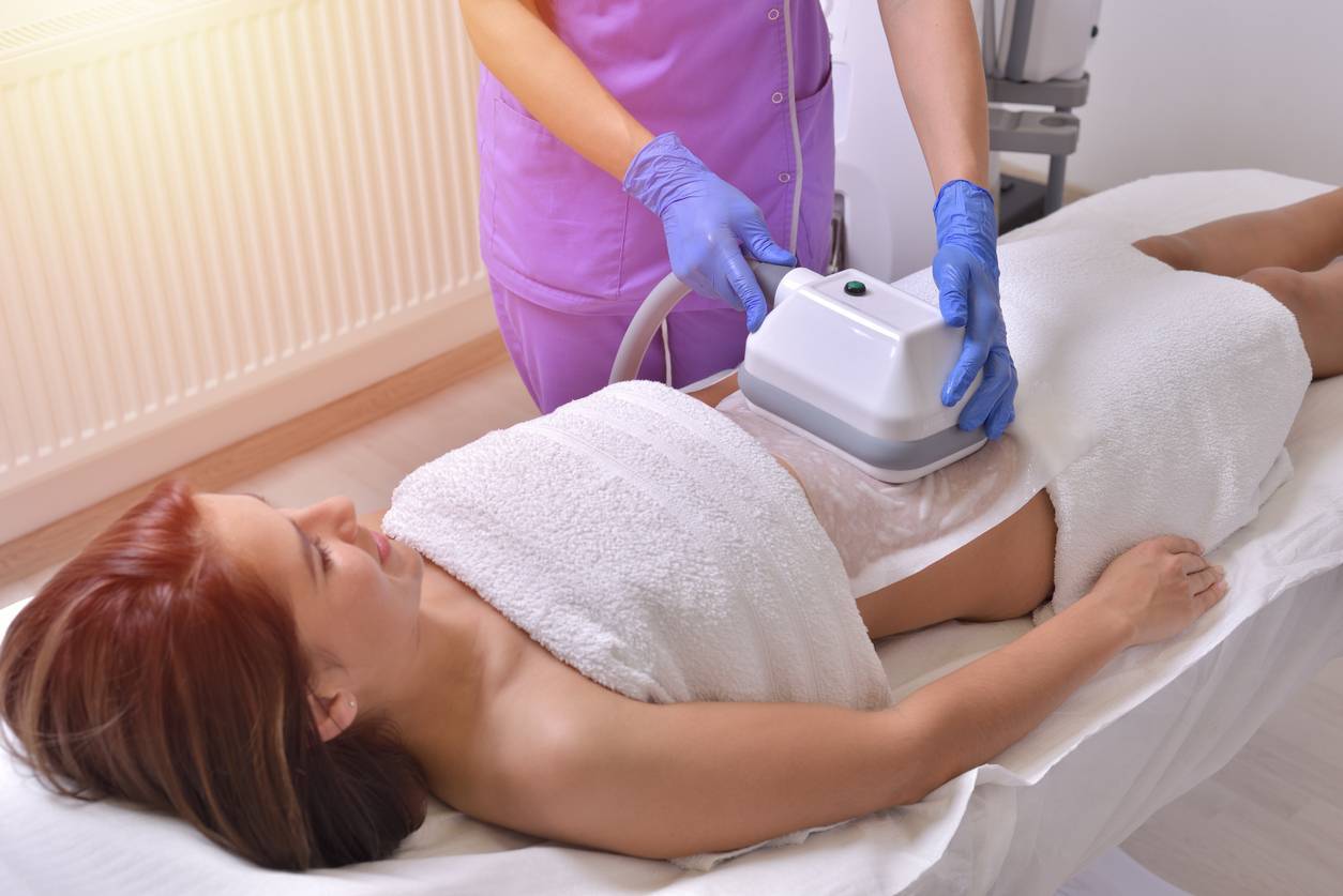 cryolipolyse médecine esthétique