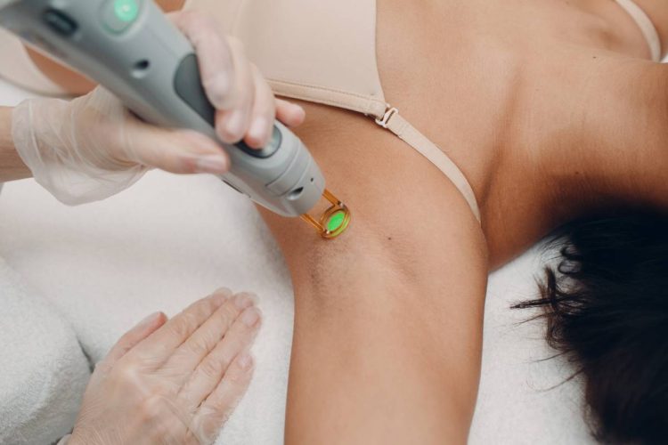 Tout savoir sur l’épilation au laser