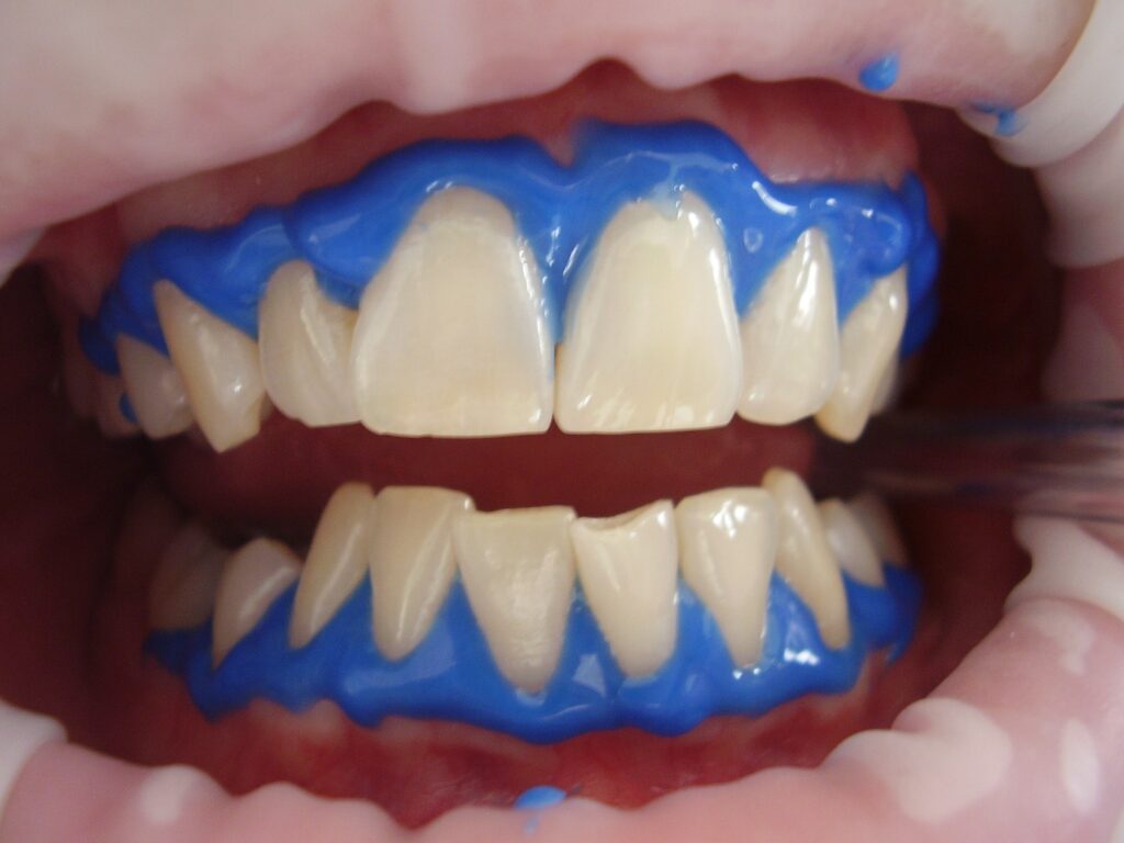 dents blancs