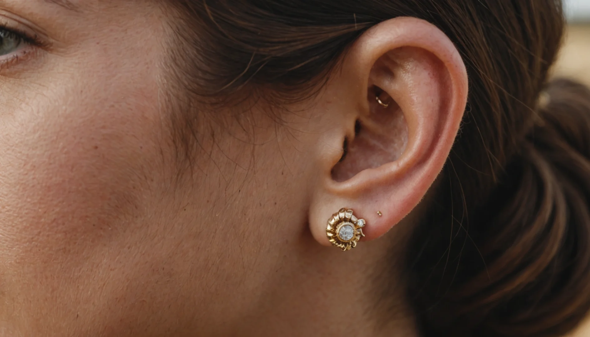 Cicatrisation conch : secret d’une oreille bijou sans douleurs ni regrets