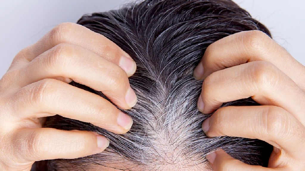 des cheveux blancs